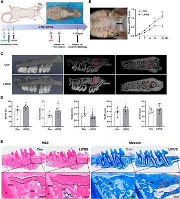 Low-intensity pulsed ultrasound regulates osteoblast-osteoclast crosstalk via EphrinB2/EphB4 signaling for orthodontic alveolar bone remodeling